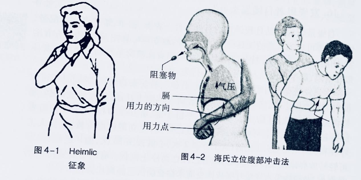 精神障碍的护理篇1
